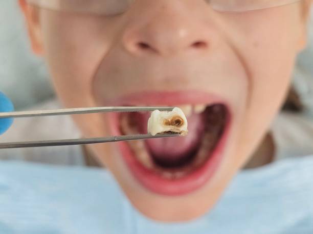 Best After-Hours Emergency Dentist in Byram Center, NJ